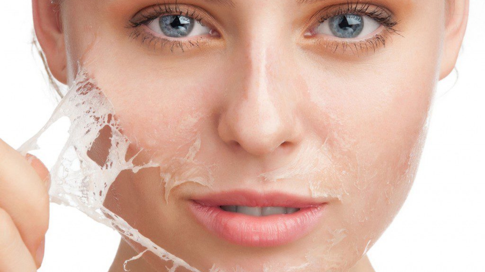 Imagem-Peeling-Quimico-1024x827-3