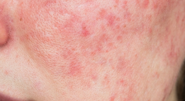 Design sem nome (42)